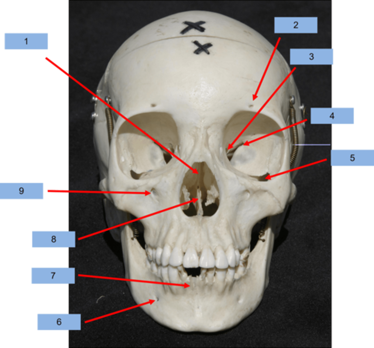 <p>What is #4 pointing to?</p>
