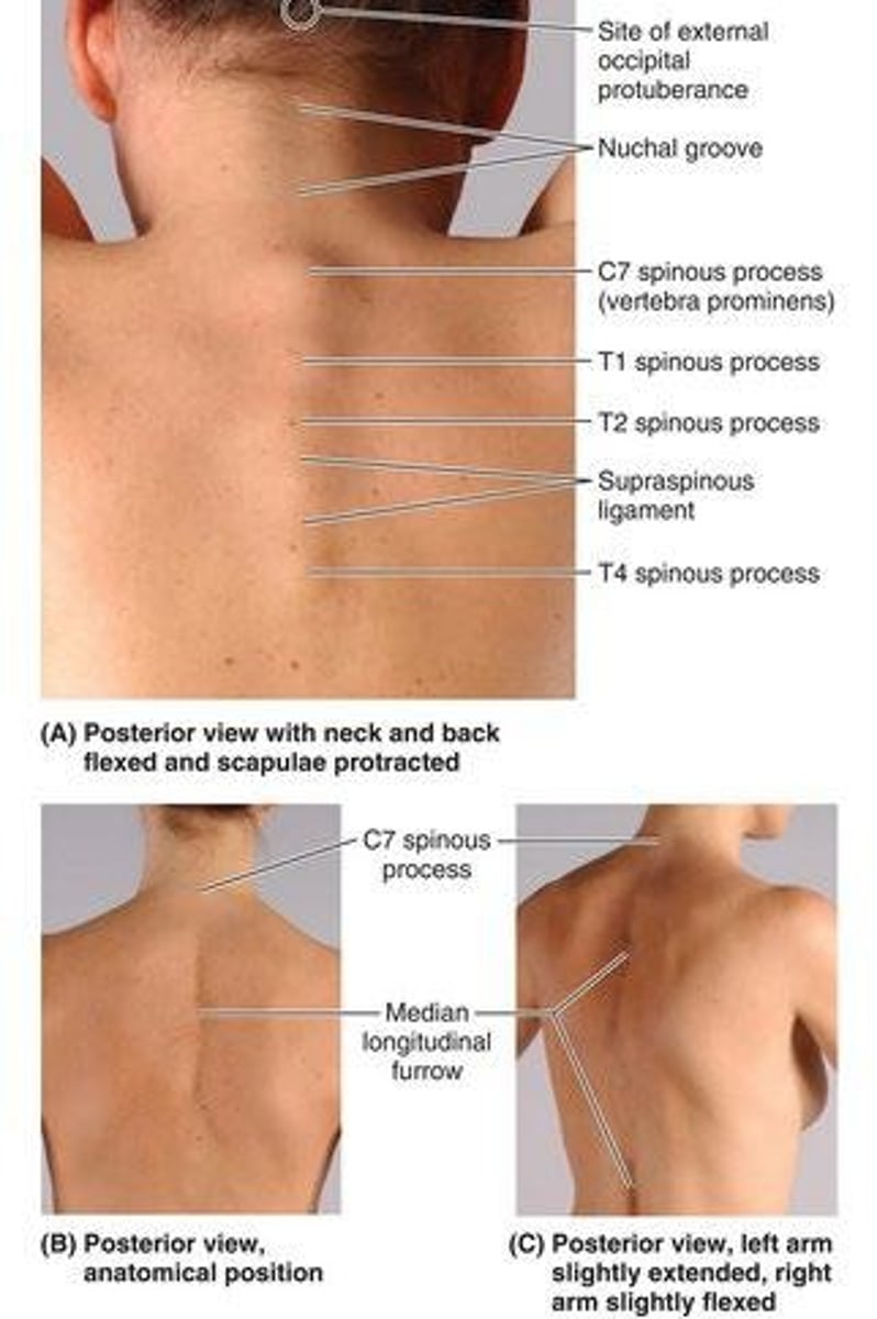<p>It is the spinous process of C7, serving as a landmark for various anatomical structures.</p>