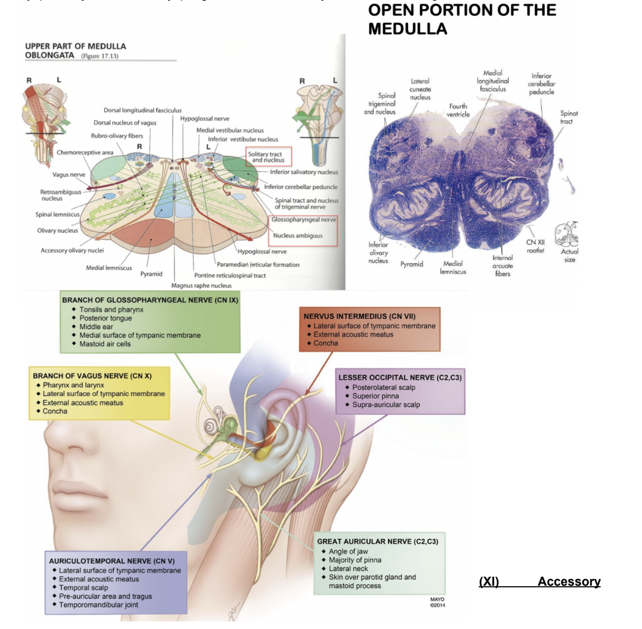 <p>10th cranial nerve, originating from the <u>medulla</u> at the level of the retro-olivary groove — very large territory of innervation with 5 components —</p><ul><li><p>SVE (branchial motor) component —</p><ul><li><p>Innervates muscles of larynx &amp; pharynx, with <u>nucleus ambiguous</u> giving rise to these fibers</p></li></ul></li><li><p>GVE —</p><ul><li><p>All viscera in thorax &amp; abdomen are innervated through parasympathetic preganglionic fibers —</p></li><li><p>Originate from <u>dorsal motor nucleus</u> of vagus nerve in medulla, and then are linked to many ganglia &amp; ENS (enteric NS)</p></li></ul></li><li><p>GVA —</p><ul><li><p>Collects informatin from all the viscera in which it passes — originate from <u>nucleus of solitary tract</u></p><ul><li><p>(same nucleus that collects taste info in its most rostral part)</p></li></ul></li></ul></li><li><p>GSA —</p><ul><li><p>Collects general sensation from the ear (with facial &amp; glossopharyngeal brings information from most of territory of the head)</p><ul><li><p>Related to <u>bulbospinal trigeminal nucleus</u></p></li></ul></li></ul></li><li><p>SVA —</p><ul><li><p>Collects taste information from the tongue, originating from <u>nucleus of solitary tract</u></p></li></ul></li></ul>