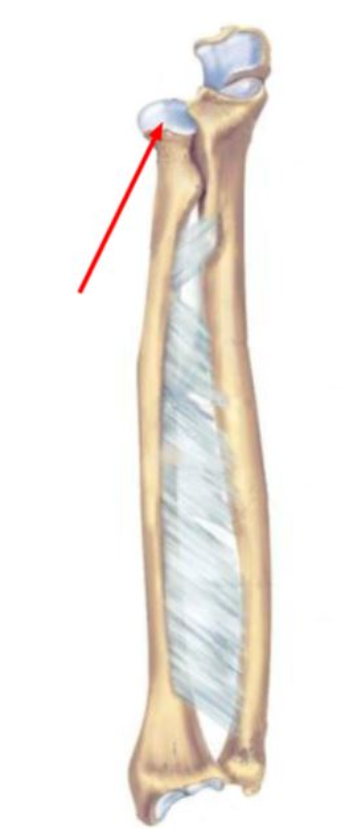 Identify the structure indicated in the figure.