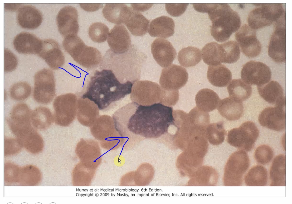 <p>What are these? What virus?</p>