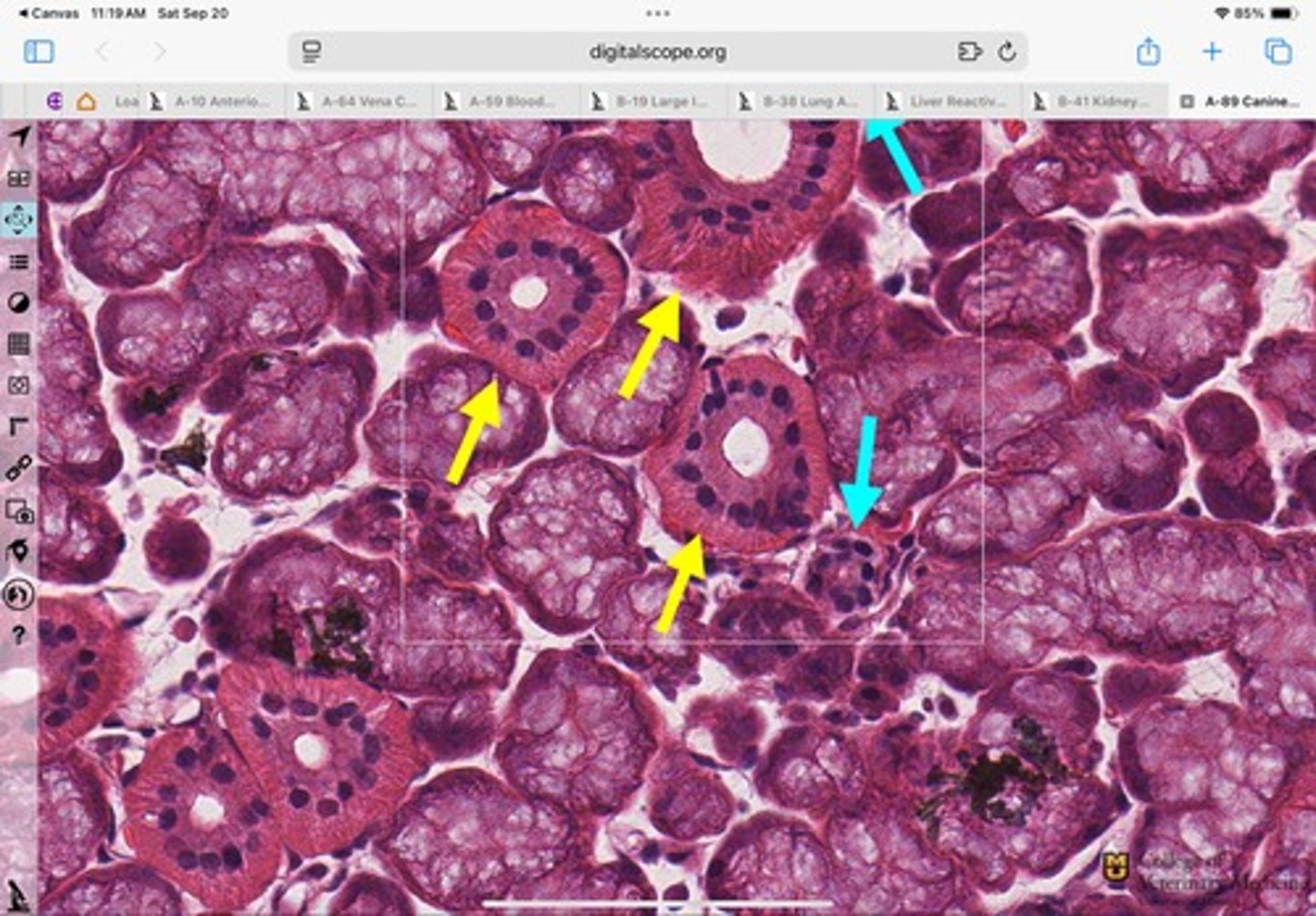 <p>What type of epithelium is shown surrounding this structure?</p>