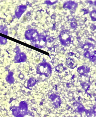 <p>Identify the specific special structure pointed at.</p>