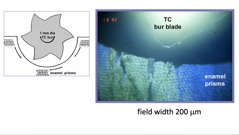 <p>cracks may affect the integrity of the restoration&nbsp;</p>