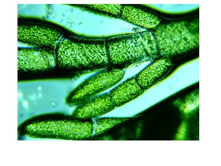 <p>How many nuclei are there in each cell of this alga?</p><p>1</p><p>&gt;1</p><p>&lt;1</p><p>0</p>