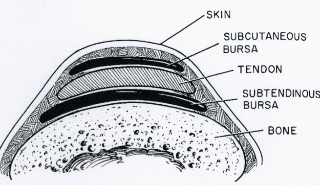 <p>A small sac containing synovial fluid</p><p>Like joint capsules, there is an outer fibrous layer and an inner synovial layer</p><p>Bursae are located between highly mobile structures and structures under high tension (usually between tendon and bone, but may also be between fascia and skin) Thus, they act like cushions and reduce friction to prevent damage to said structures</p>