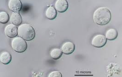 <p>Yeast cells </p>