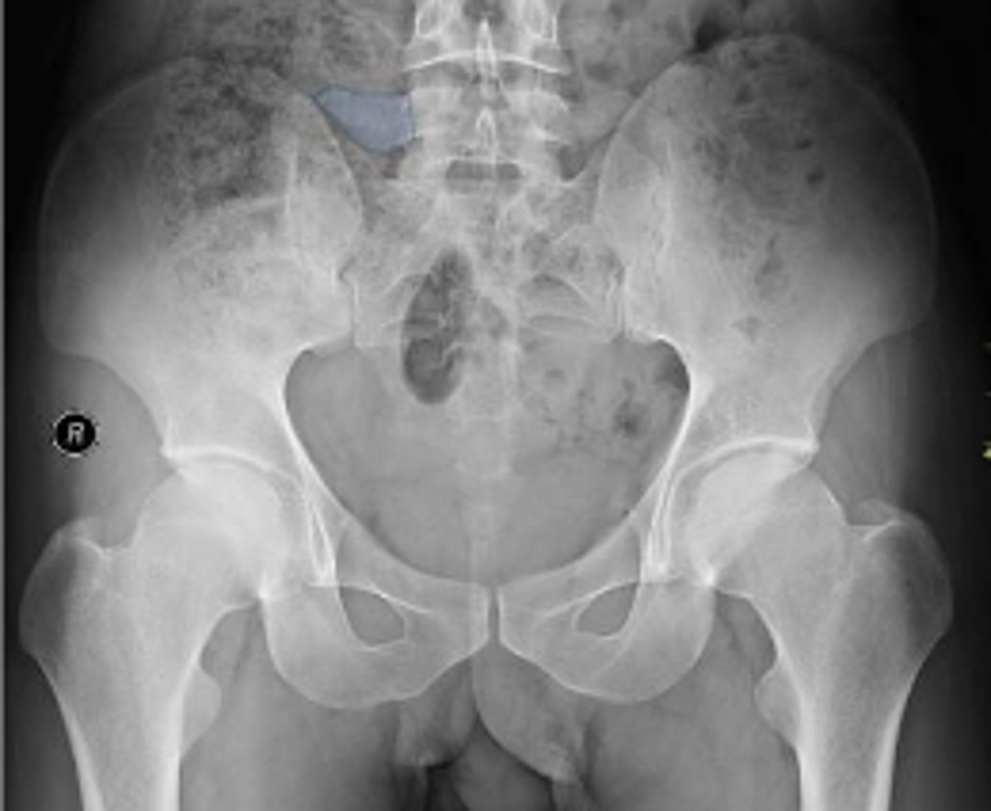 <p>What is outlined?</p>