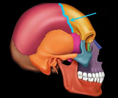 <p>the suture between the parietal and frontal bones of the skull</p>