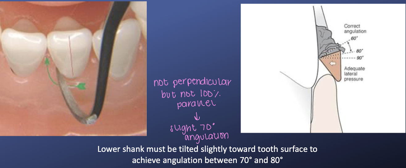 <p>lower shank must be tilted towards the tooth surface to achiever angulation between 70-80 degrees → lower shank should not be perpendicular but not 100% parallel </p>