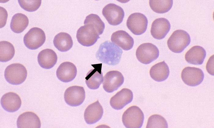 term image