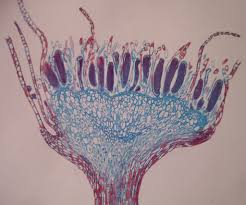 <p>Which division does this Antheridial Head belong to?</p>