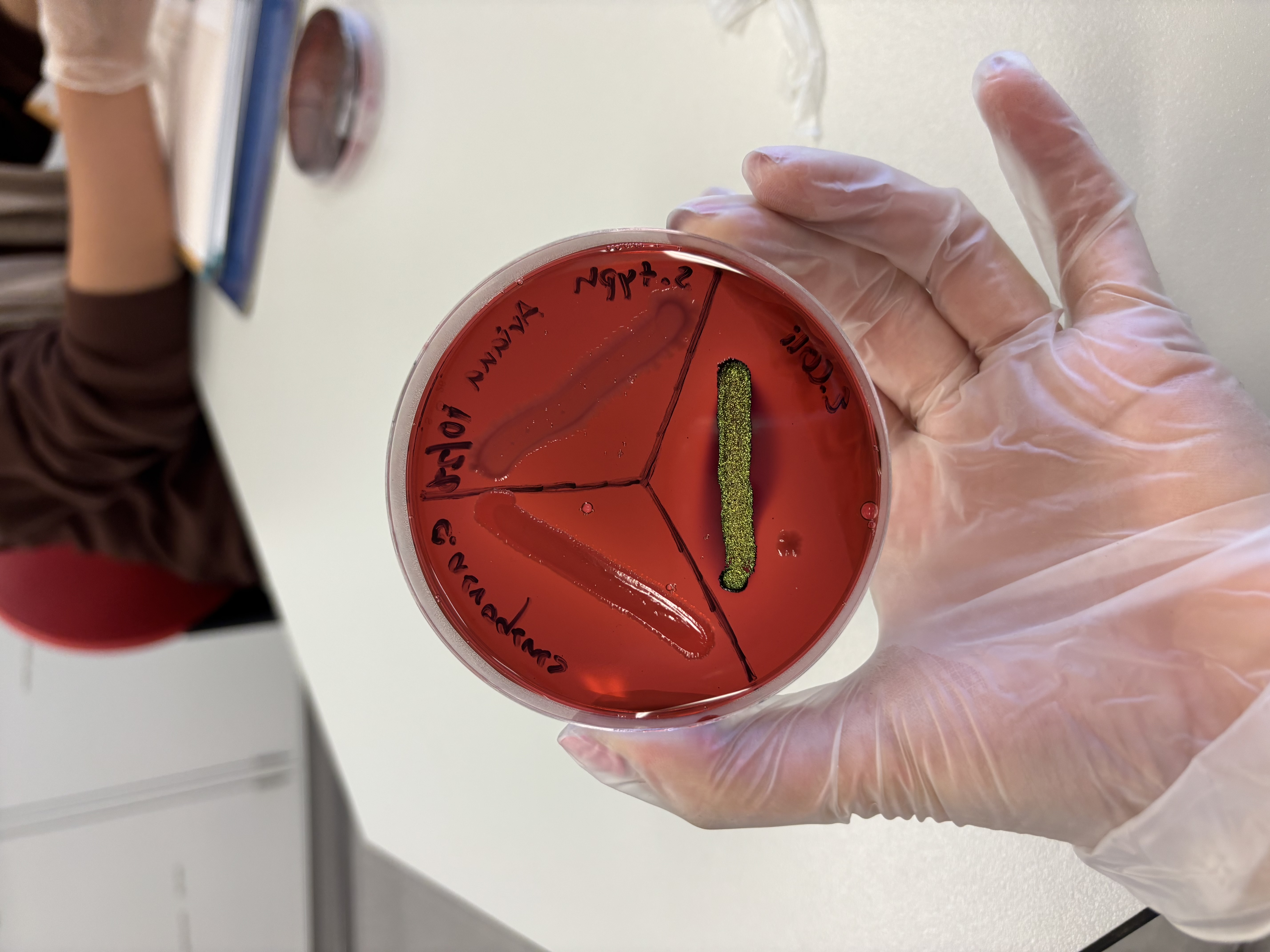 <p><strong>Positive:</strong></p><ul><li><p>Metallic green sheen (strong fermenter)</p></li><li><p>Purple/dark colonies (moderate fermenter)<br><strong>Meaning:</strong> Lactose fermentation<br><strong>Example:</strong> <em>E. coli</em></p></li></ul><p></p>