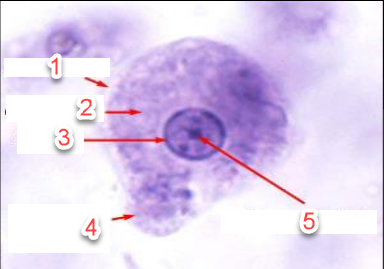 Trofozoíto de Entamoeba histolytica --1. ectoplasma, 2. Endoplasma, 3.Nucleo, 4. Pseudópodo, 5. Endosoma central