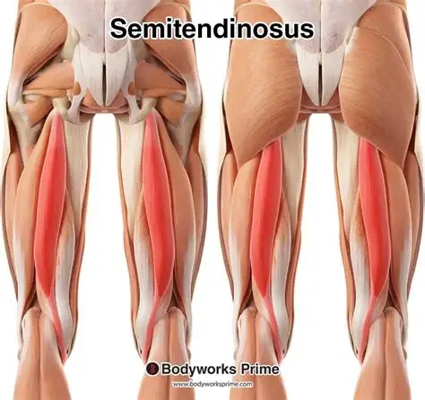 <p>Long cord-like hamstring medial to biceps extends hip & flexes knee. (Tibial nerve). ๐ Visible as thick strap โ pes anserinus. ๐ก "Tendon = tail of hamstrings."</p>