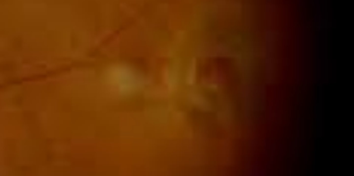 <p>holes in the retina caused by abnormal vitreo-retinal adhesion which may be preceded by a retinal tuft. A portion of sensory retina detaches from the RPE (operculum) and remains attached to the vitreous. If the operculum does not completely detach, refer to retina is indicated due to slight increased chance of retinal detachment. Treatment is the same as for an atrophic hole.</p>