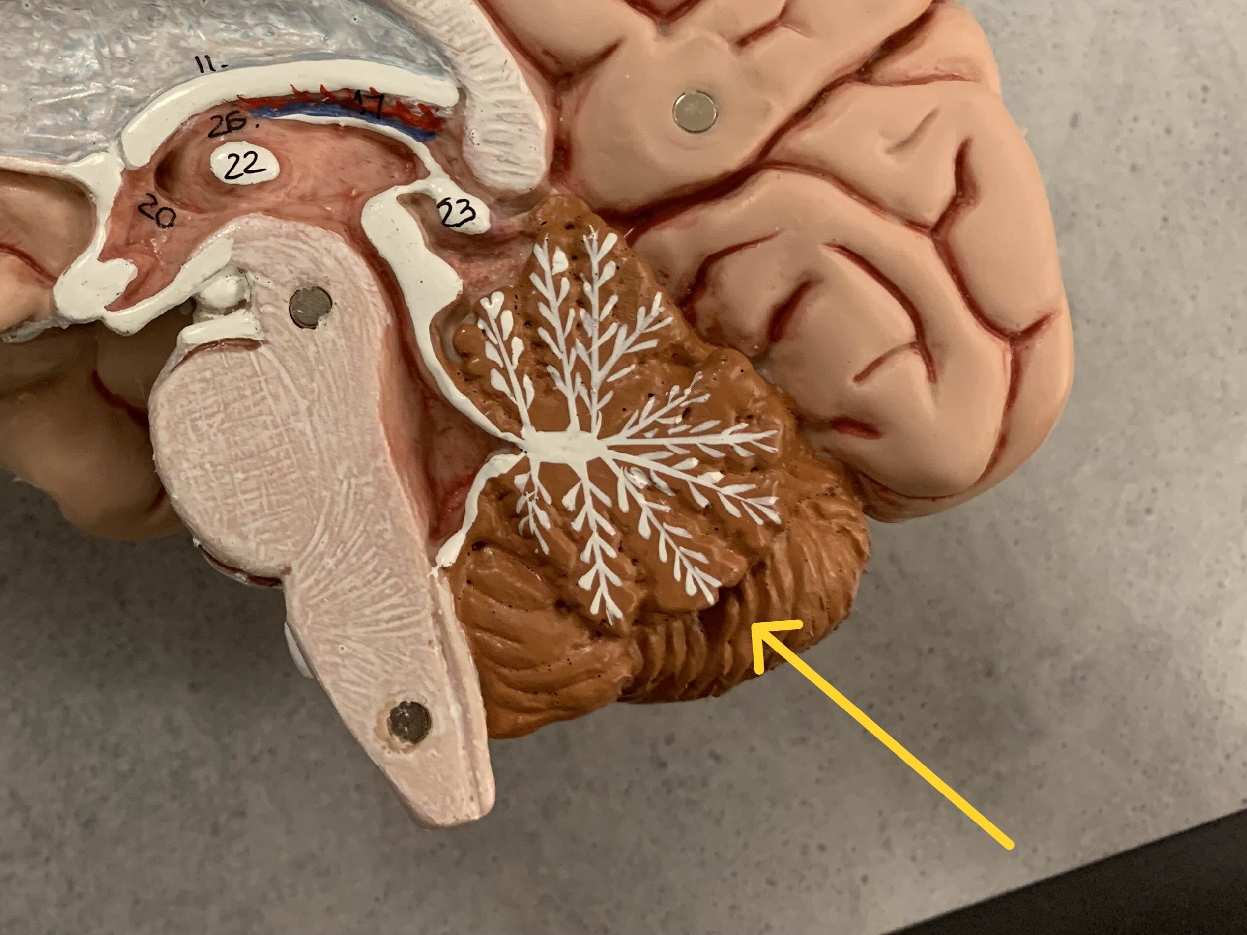 <p>Which part of the cerebellum is:</p><ul><li><p>Outer layer of cerebellum</p></li></ul><p></p>