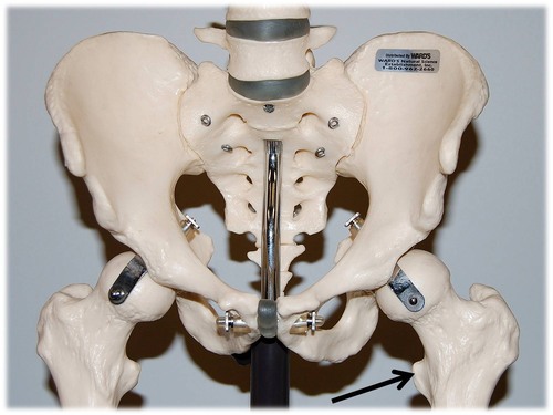 Name this specific part of the femur.