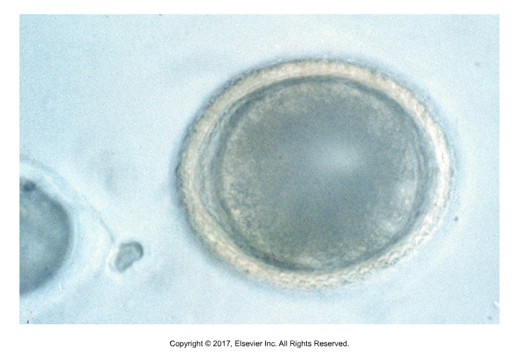 <p>Single cell within egg shell, oviporous</p>