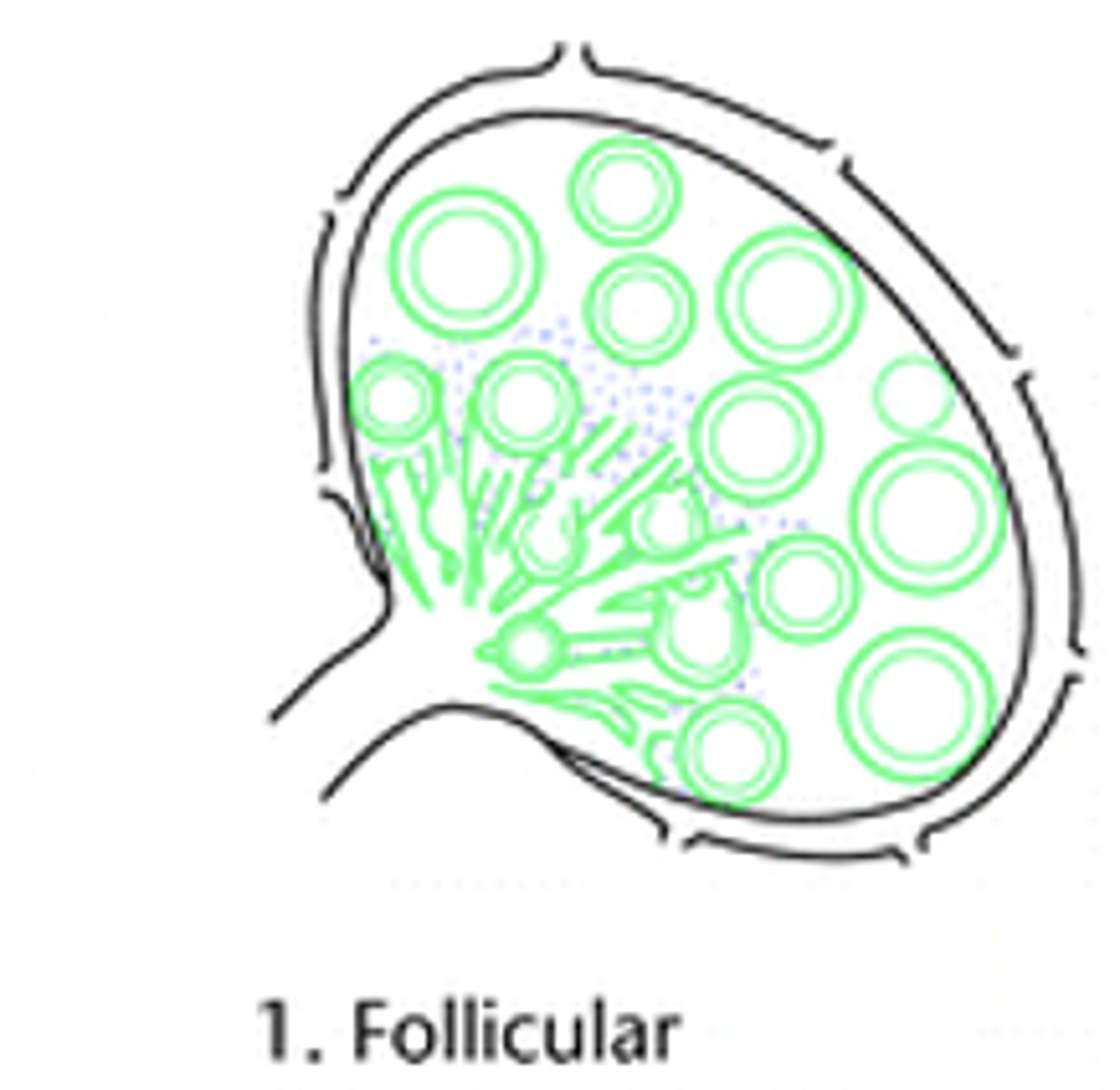 <p>What are the causes of Follicular Chronic Lymphadentis?</p>