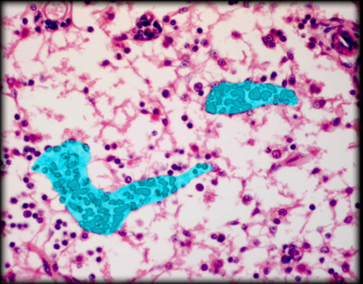 <p>Lymph node</p>