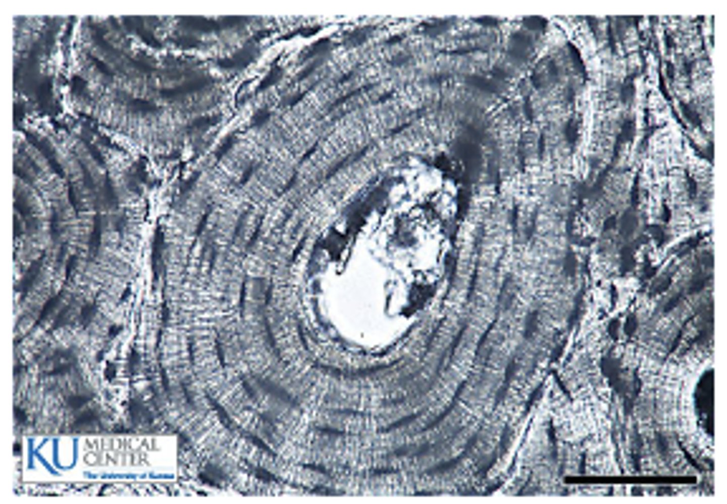 <p>Outer shell</p><p>Densely packed, calcified extracellular matrix (more rigid)</p><p>Functional Unit: Osteon</p>