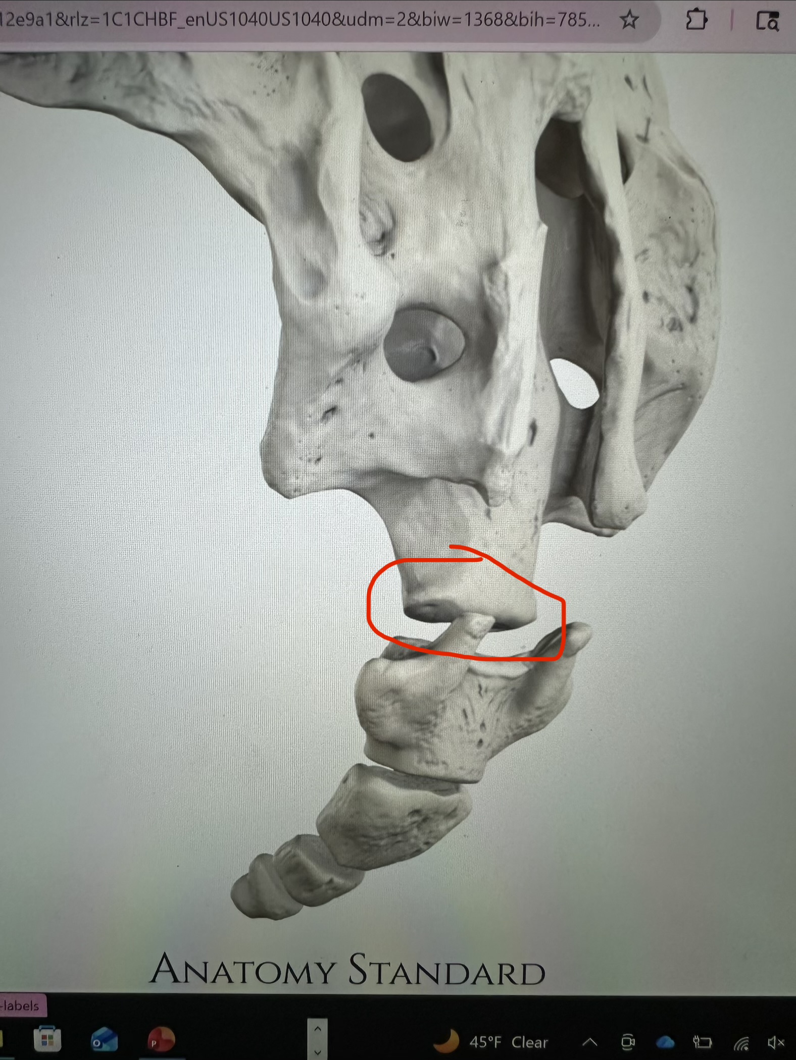 <p>sacrum, flat bottom bit</p>