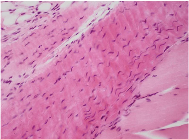 <p>what tissue is this&nbsp;</p>