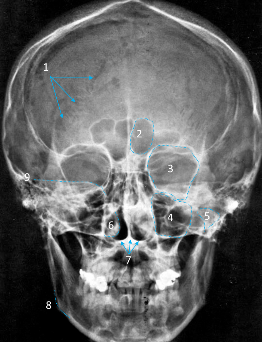 <ol start="6"><li><p>ID structure</p></li></ol><p></p>