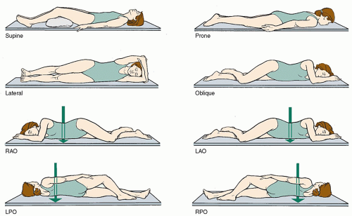 <p>A position where the left side of the body is against an imaging screen and leaning forward at an angle </p>