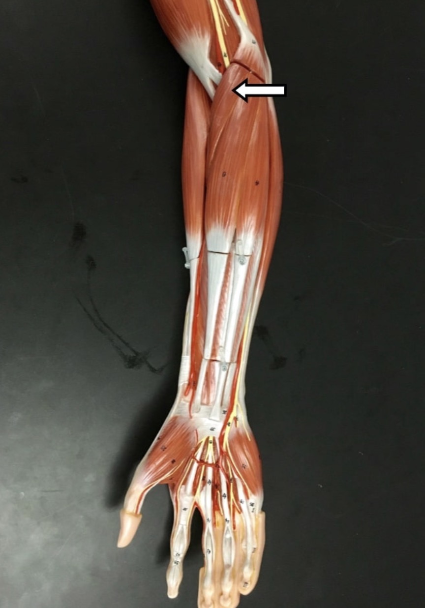 <p><span>Name the muscle labeled with the white arrow below AND name the insertion.</span></p>