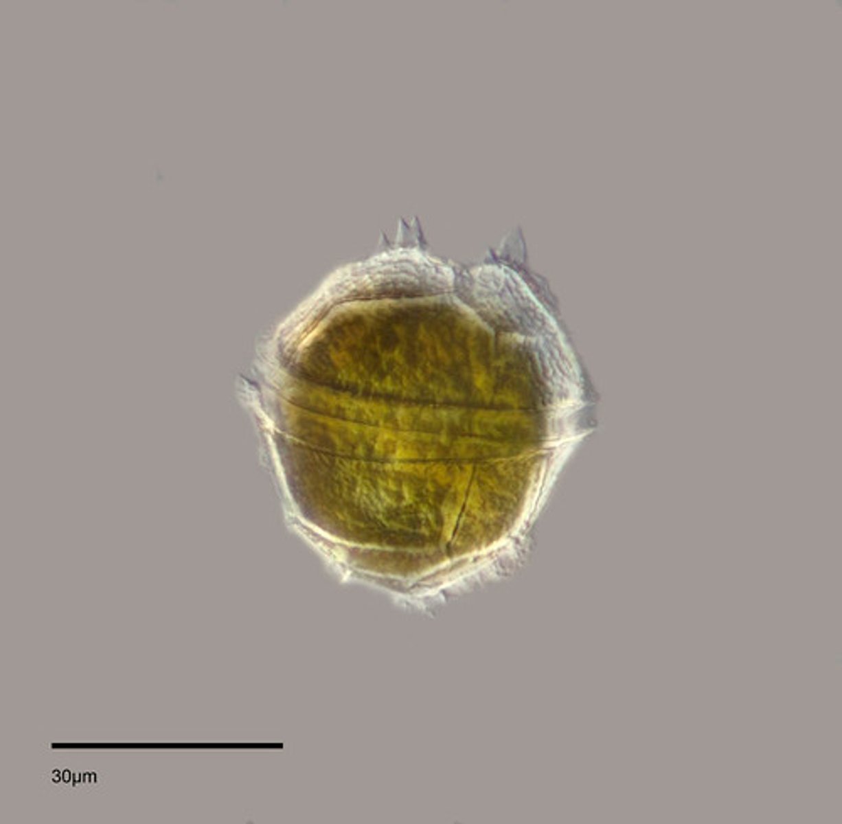 <p>caused by dinoflagellate (algae) NEUROTOXIN - brevetoxin</p>