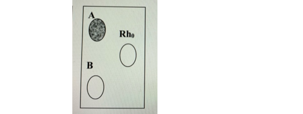 <p>what is this person’s blood type?</p>