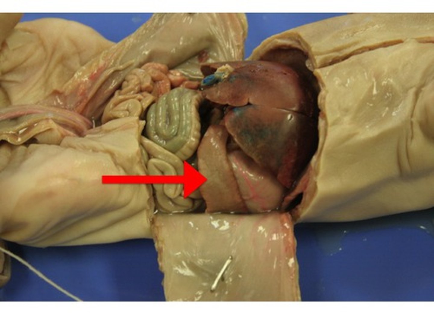 <p>This organ filters blood of old red blood cells.</p>