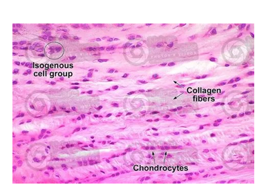 <p>What type of cartilage is this </p>