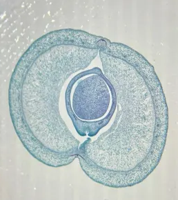 <p>Which fruit is being shown?</p>
