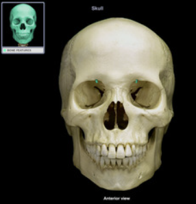 <p>sometimes known as a supraorbital notch (frontal incisura is the same thing; incisura is another word notch), when it is incomplete.</p>