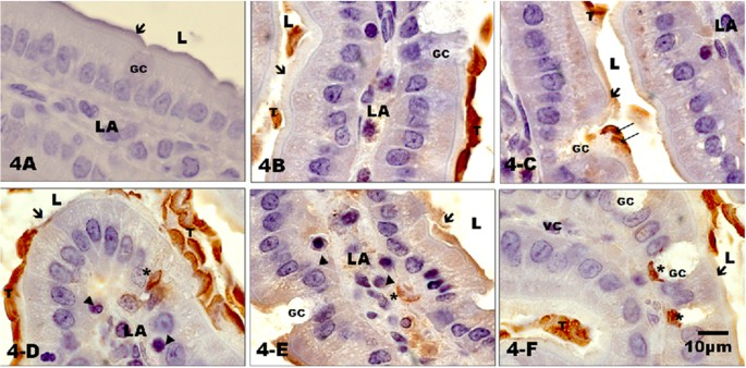 <p>How can <em>Giardia lamblia</em> survive w/out a mitochondria? <sup>(how does it synthesize enough ATP)</sup></p>