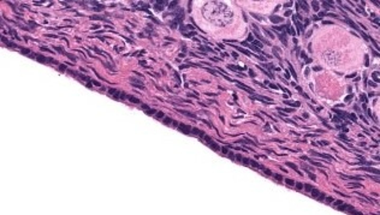 <p>outer surface of the ovary</p>