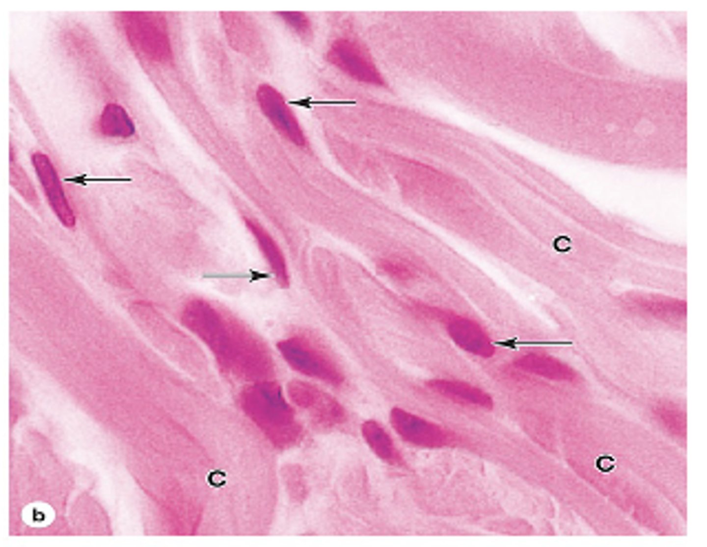<p>What is the staining characteristic of Type I collagen fibers?</p>