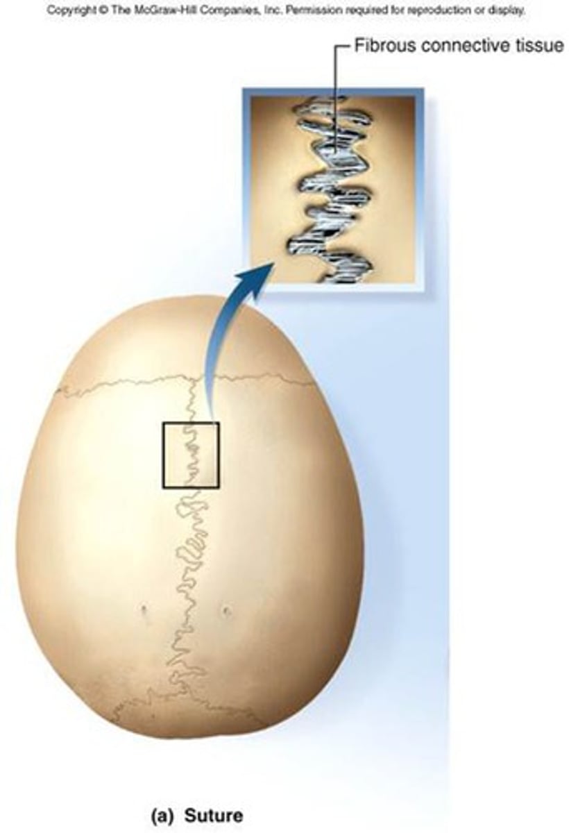 <p>Immovable, Ex: sutures & synchondroses</p>