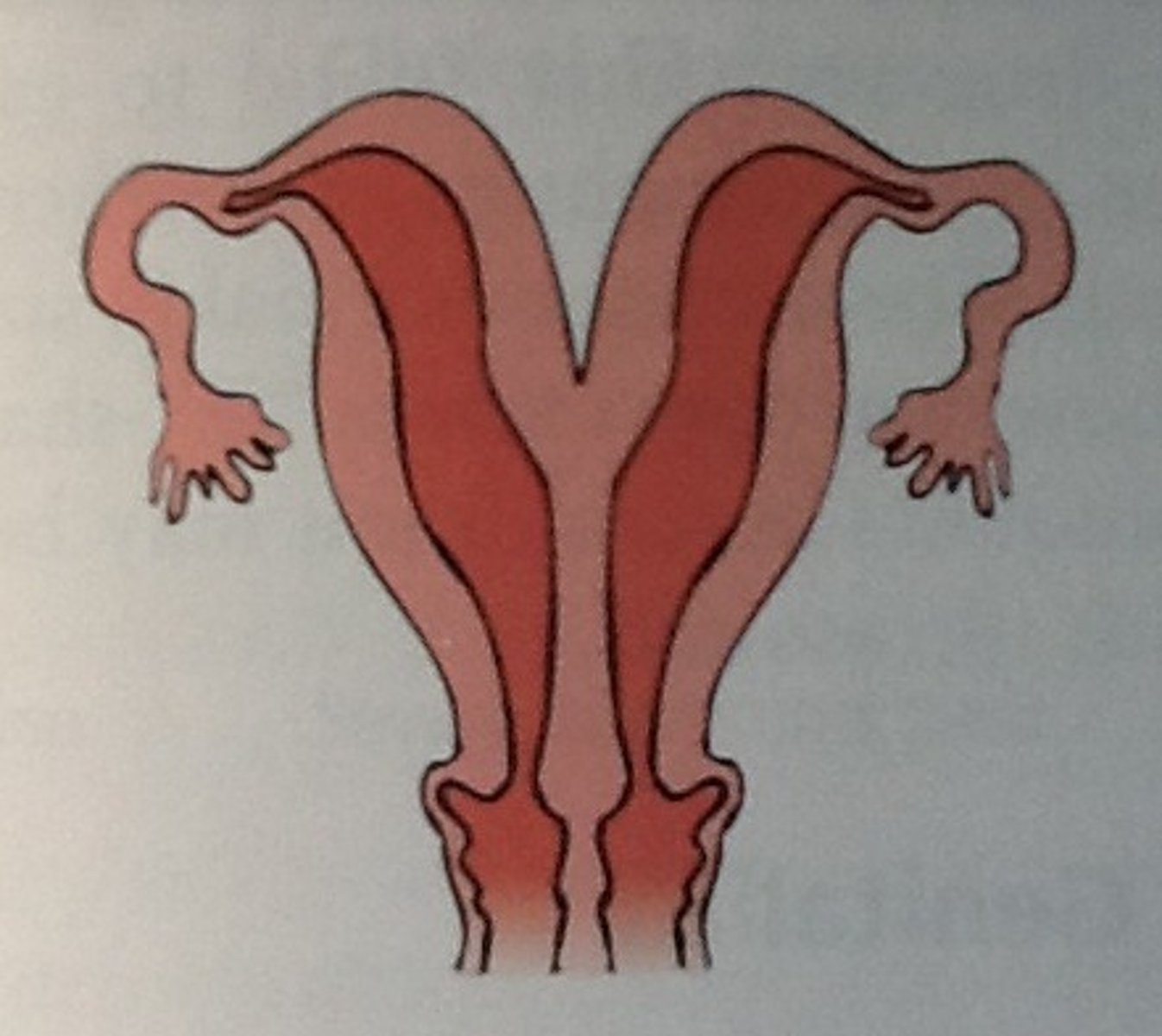 <p>Double uterus, double cervix, double vagina</p>