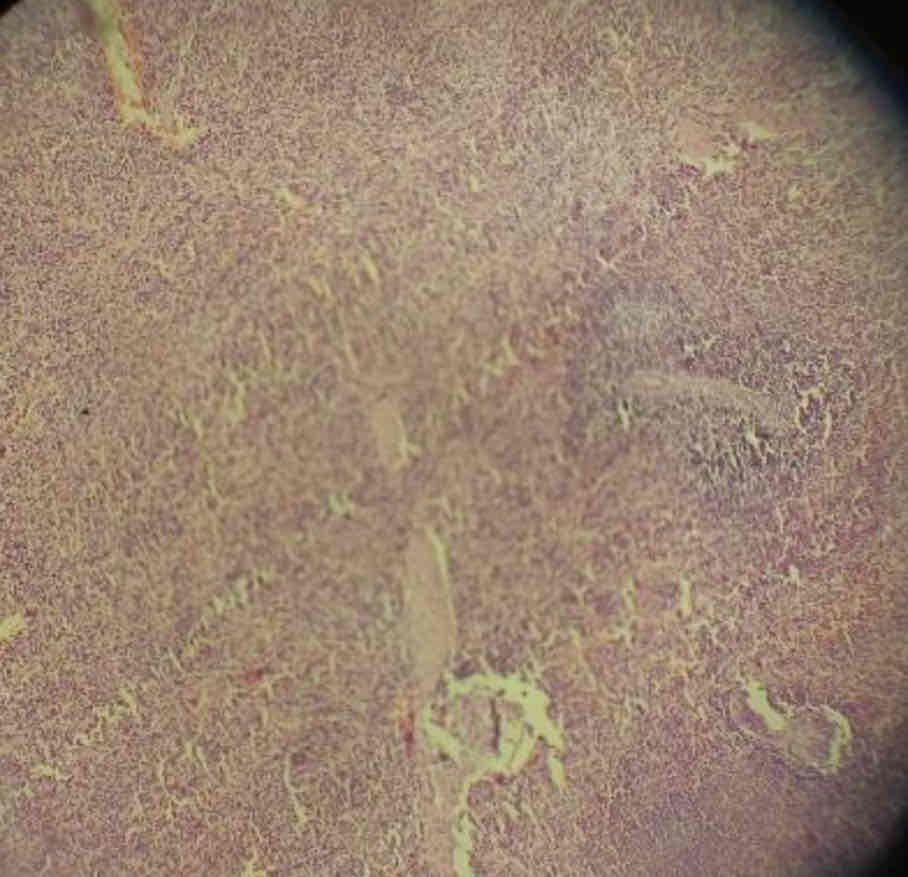 term image