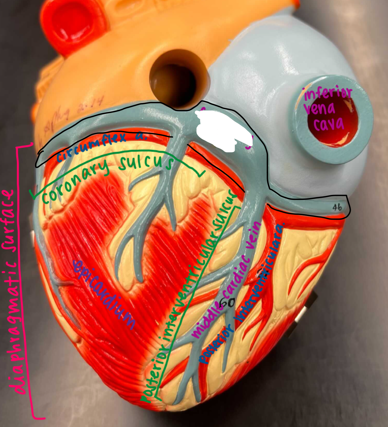 <p>The large thick blue on the bottom of the heart underneath the inferior vena cava</p>