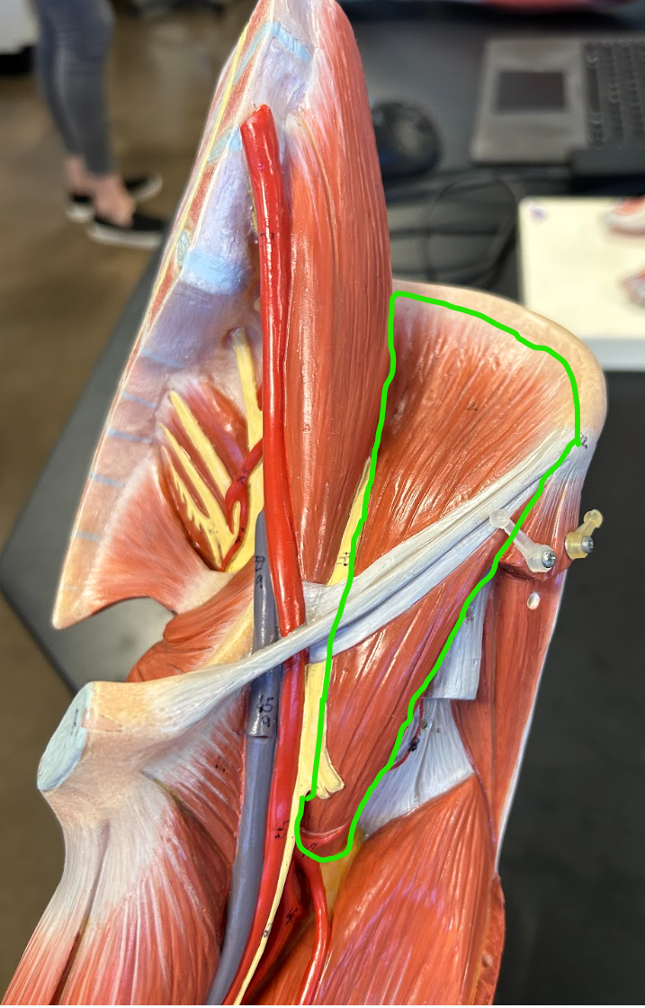 <p><span style="font-family: Arial, sans-serif">What are the actions of this muscle?</span></p>