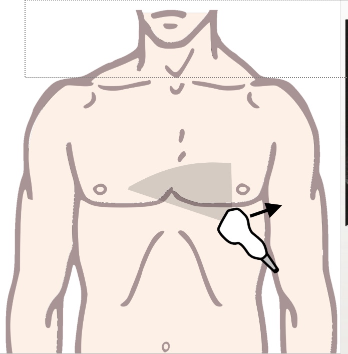 <p>What echo view will this position give you?</p>