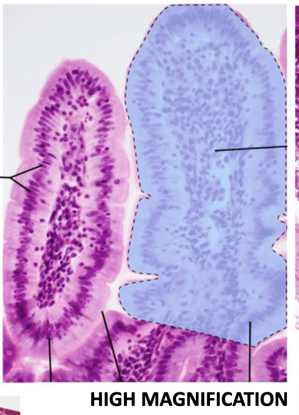 <p>What is the arrow point at?</p>