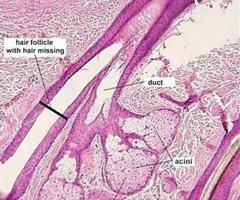 <p><span>exocrine glands in the skin that produce and secrete sebum, an oily substance that lubricates and waterproofs the skin and hair</span></p>