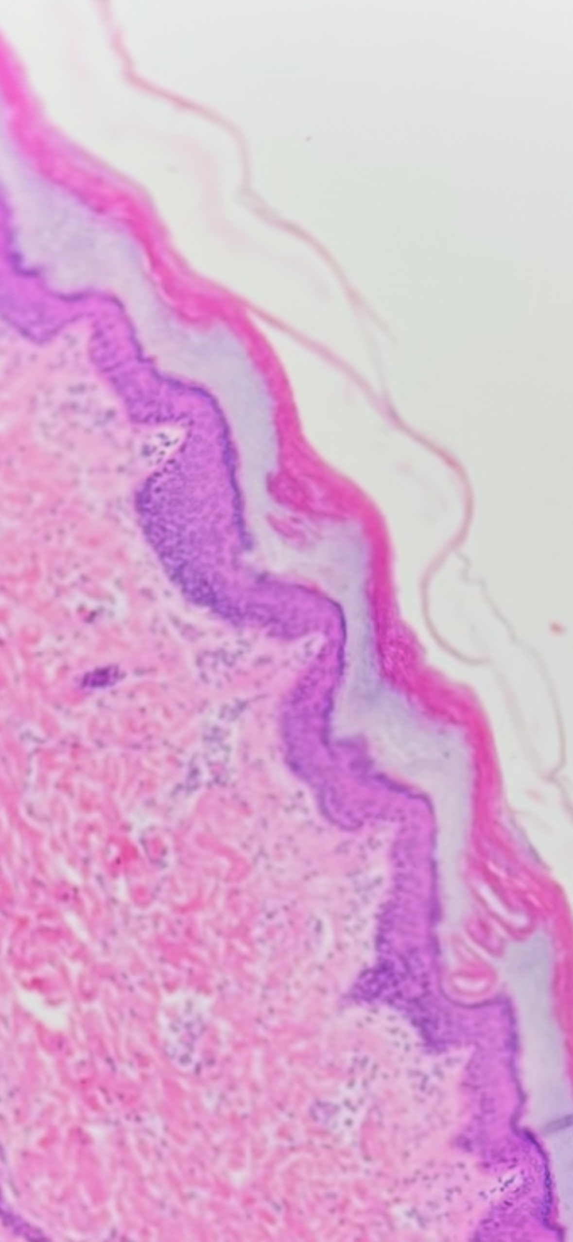 <p>Strtified squamous epithelium</p>