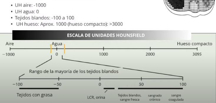 <p><span style="color: red"><strong>Tiene 2000 densidades- UNIDADES DE HPUNSFIELD</strong></span></p><p>Agua tiene 0 unidades hounsfiel, si es más denso hay hasta 1000 unidades, en cambio lo que sea menos denso, son negativos hasta -1000</p>